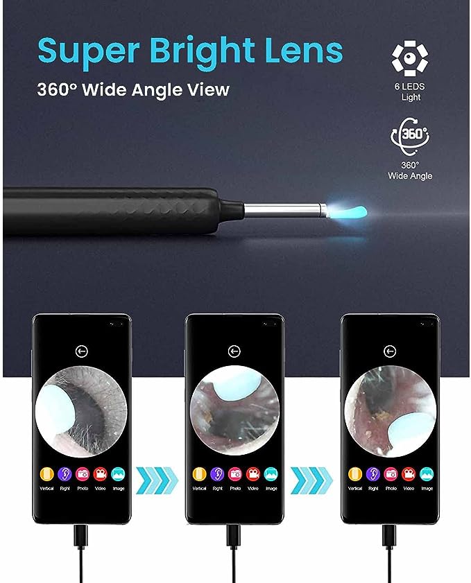 Ear Wax Cleaner with HD Camera - Smart Ear Wax Remover