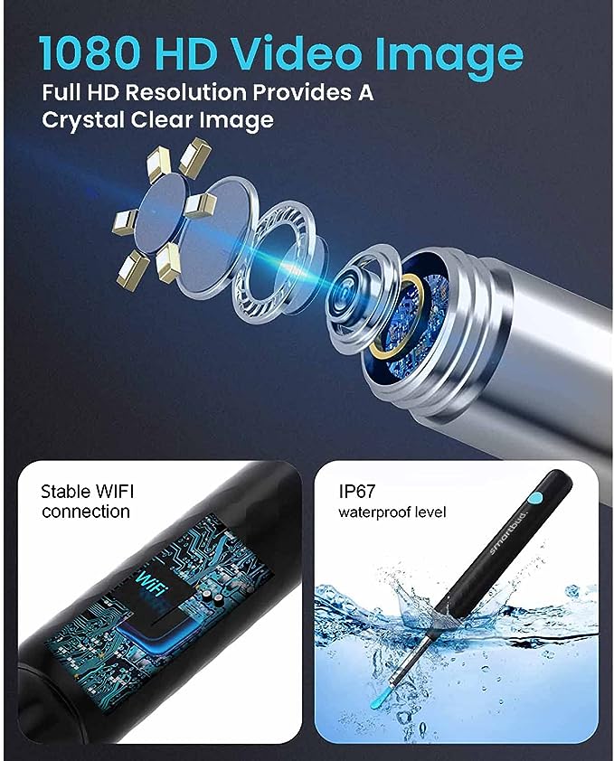 Ear Wax Cleaner with HD Camera - Smart Ear Wax Remover