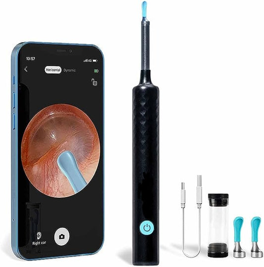 Ear Wax Cleaner with HD Camera - Smart Ear Wax Remover