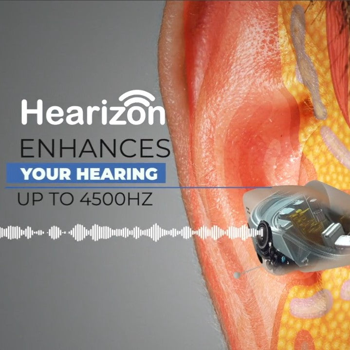 Hearizon - The Breakthrough Hearing Amplifier