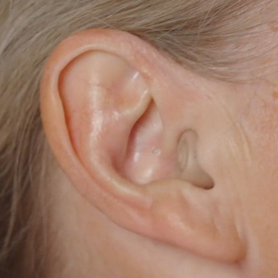 Hearizon - The Breakthrough Hearing Amplifier