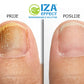 IZA EFFECT - Antifungal Spray