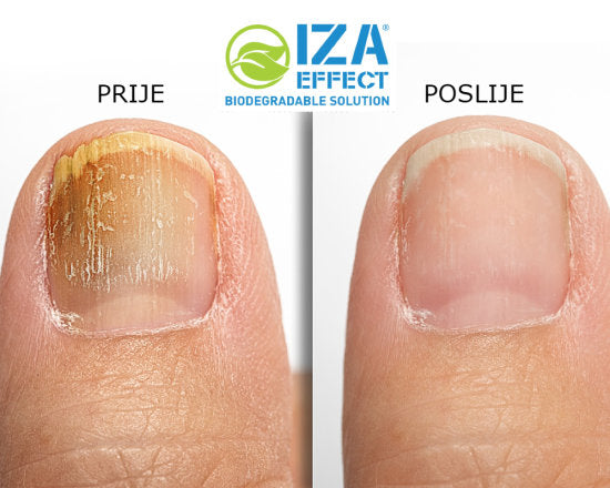 IZA EFFECT - Antifungal Spray