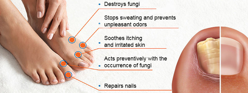 IZA EFFECT - Antifungal Spray